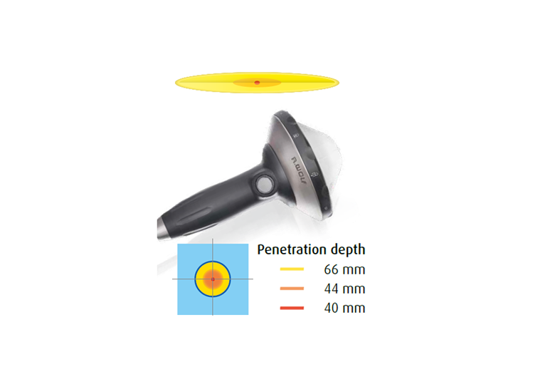 PiezoWave 2S incl. pièce à main F10 G4 - Set de gel-pads