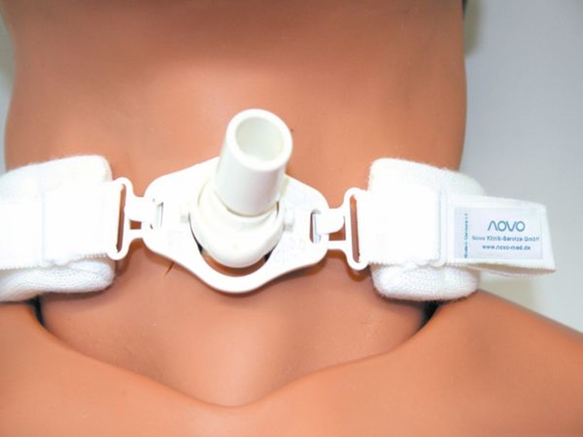 Novo BePa-Clip tracheo fixation standard - adultes - 28-33 cm réglable - 60 pcs