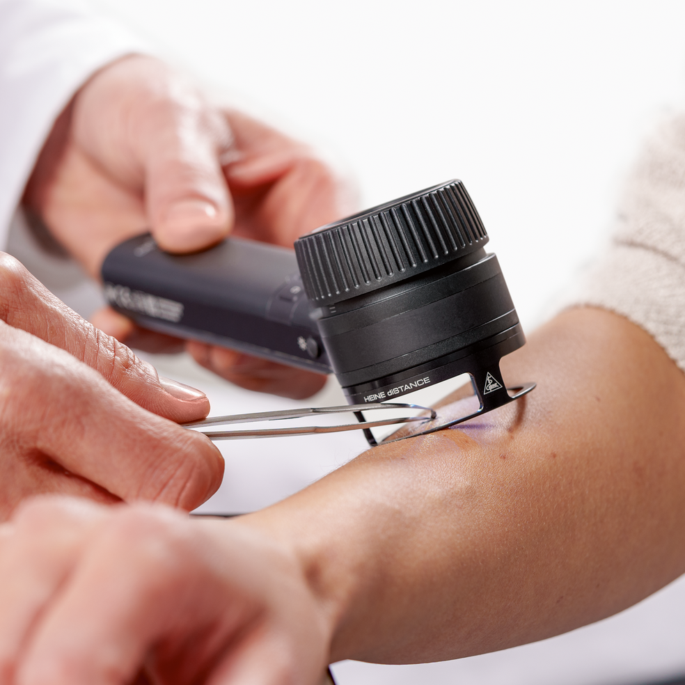 HEINE dISTANCE working ring - 1 st